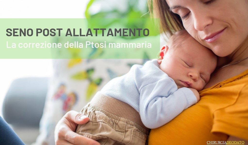 Seno post allattamento all'origine della Ptosi Mammaria - Chirurgia Deodato